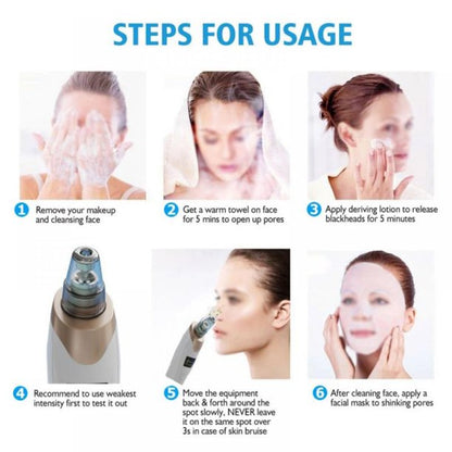 Electric Blackhead Remover Pore Vacuum – 3 Suction Levels, 5 Heads & USB Rechargeable Facial Cleaner