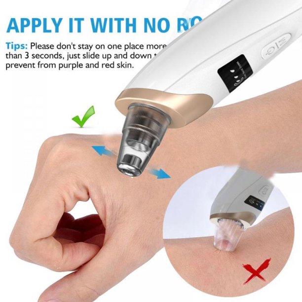 Electric Blackhead Remover Pore Vacuum – 3 Suction Levels, 5 Heads & USB Rechargeable Facial Cleaner