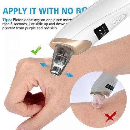 Electric Blackhead Remover Pore Vacuum – 3 Suction Levels, 5 Heads & USB Rechargeable Facial Cleaner