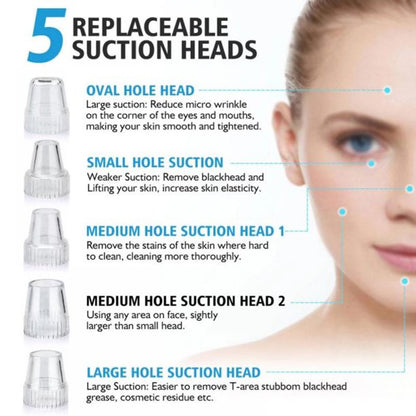 Electric Blackhead Remover Pore Vacuum – 3 Suction Levels, 5 Heads & USB Rechargeable Facial Cleaner