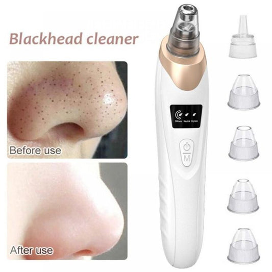 Electric Blackhead Remover Pore Vacuum – 3 Suction Levels, 5 Heads & USB Rechargeable Facial Cleaner